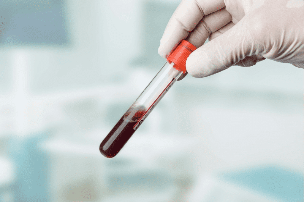Blood Transfusion: Crucial Anemia Level for Need