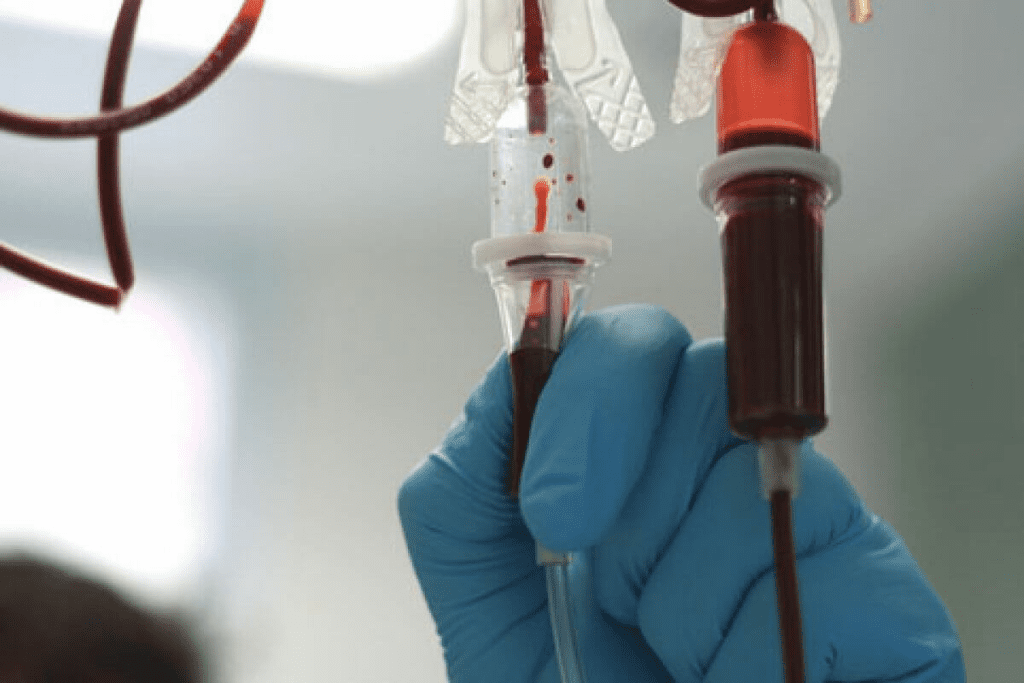 Blood Transfusion: Amazing Time for Anemia