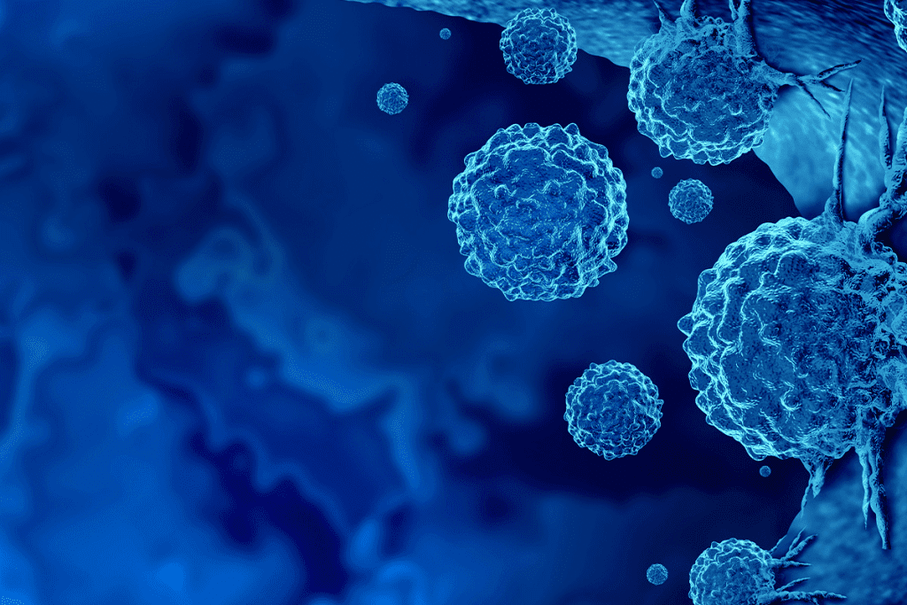 Is It the End? can immunotherapy cure stage 4 cancer or is it a Last Resort?