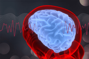 Recognizing the Cognitive Impact: What Are the Signs of brain fog?