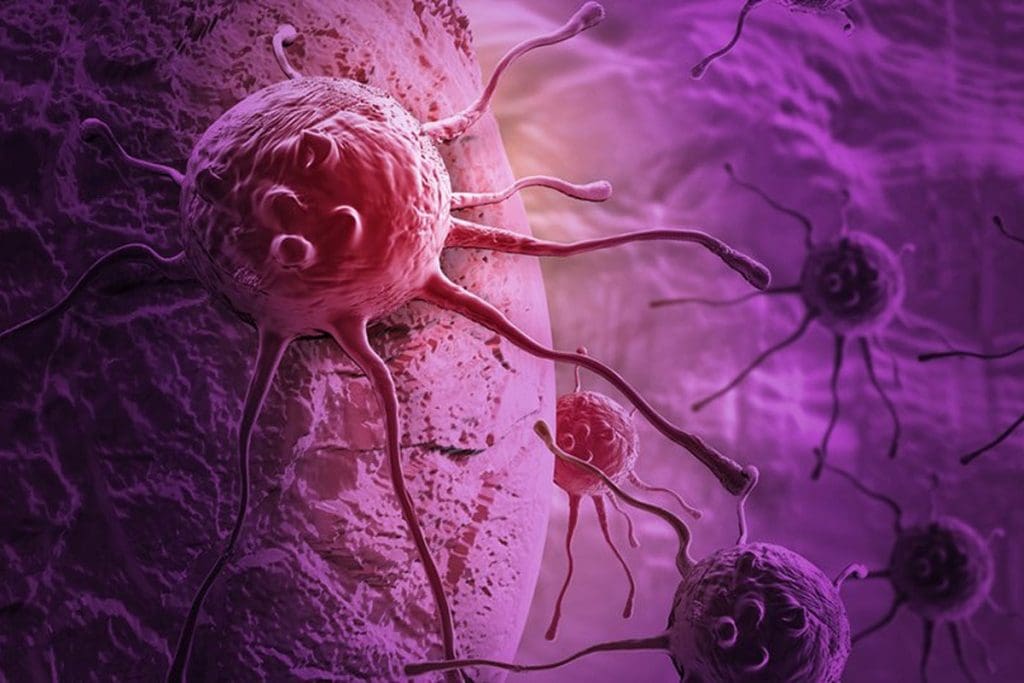 Cancer Treatment Breakthroughs Coming in 2025