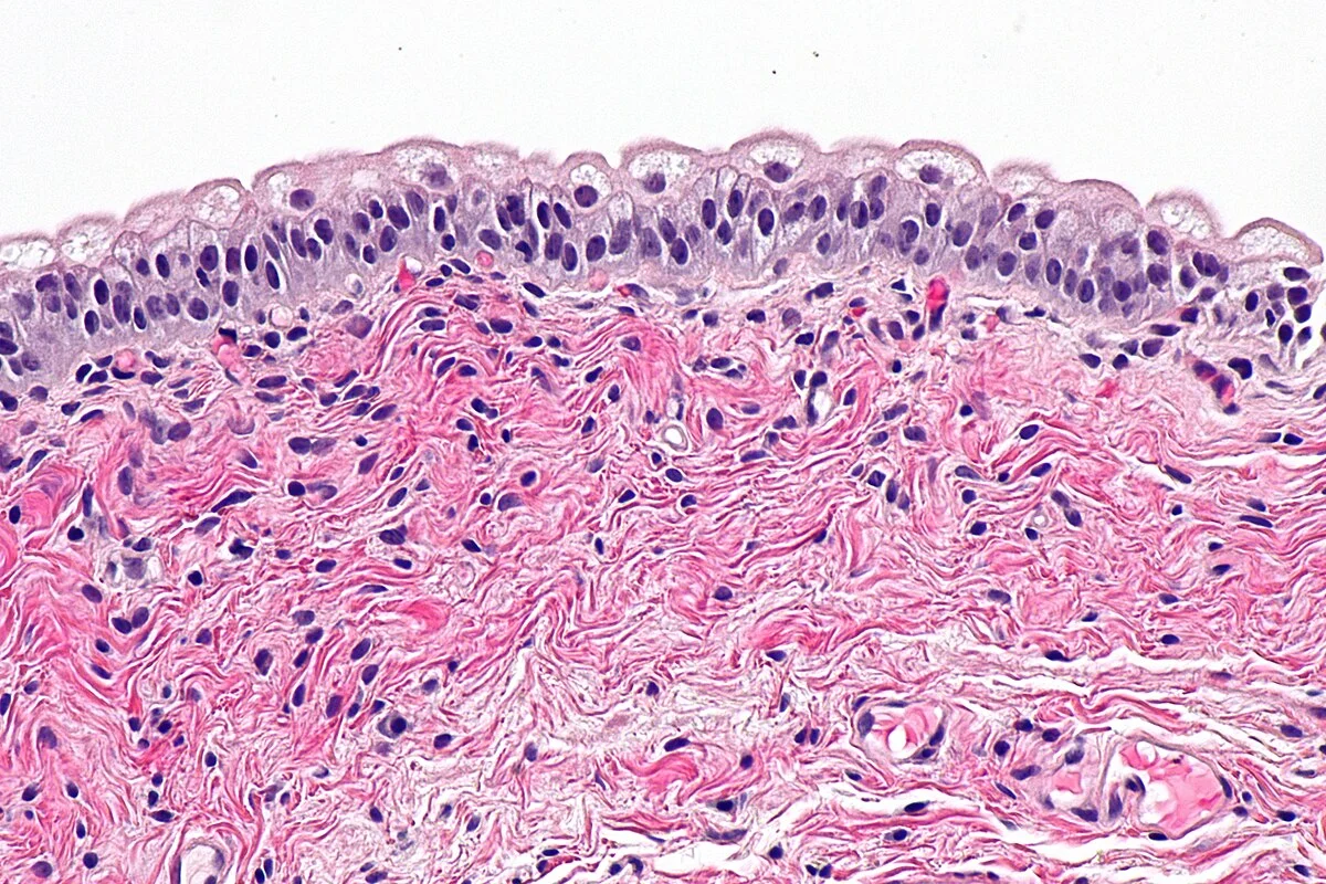 The Pathophysiology of the Urothelium