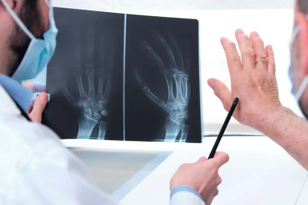 Overview and definition