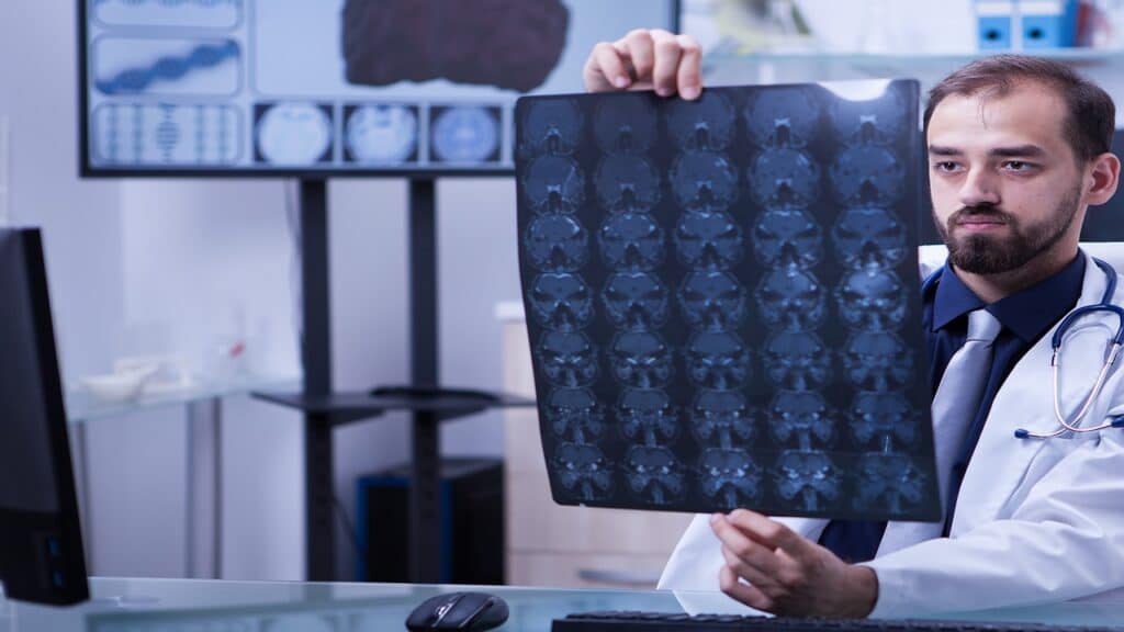 T2 Hyperintense Lesions