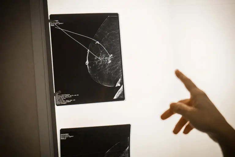 Steri Strips: The Ultimate Guide to Wound Care