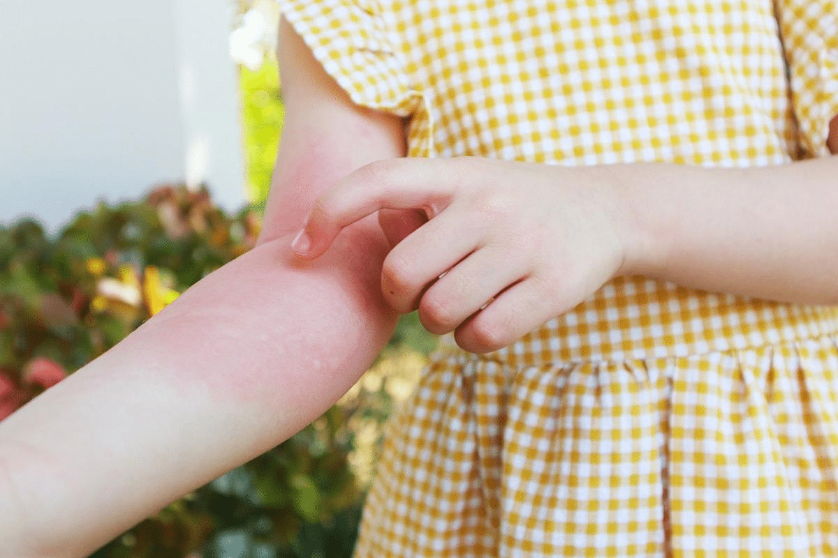 word image 258568 3 LIV Hospital