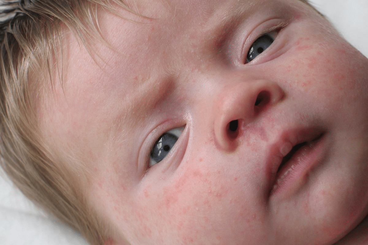 word image 258261 2 LIV Hospital