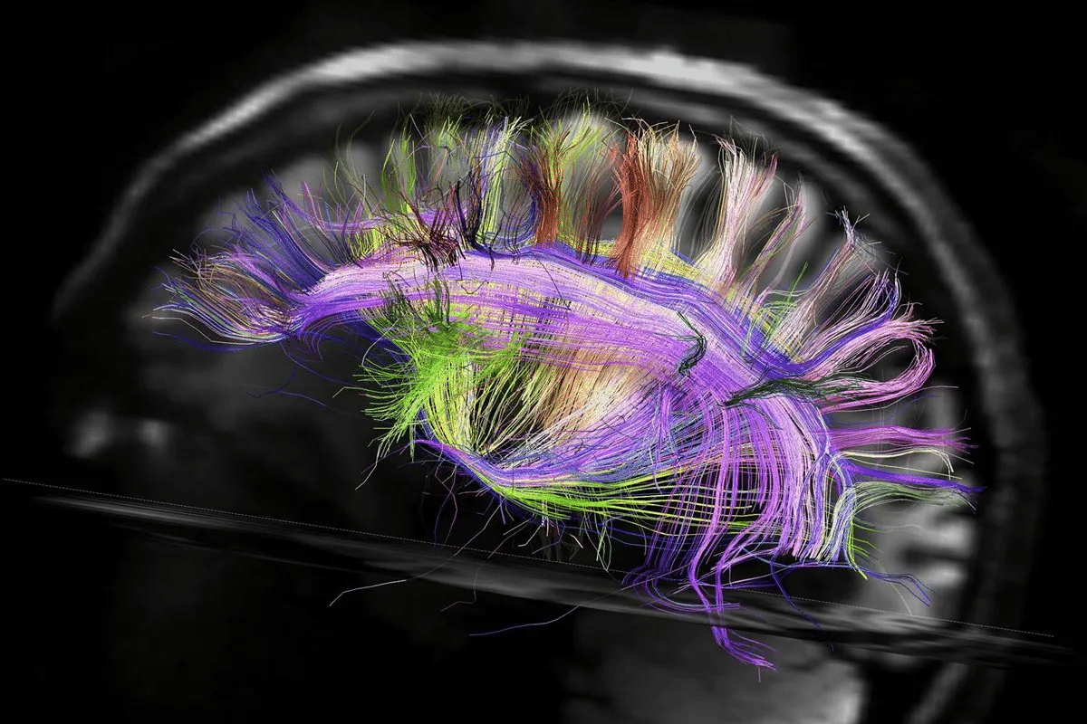 Brain Cells Dying: Best Causes & Cures