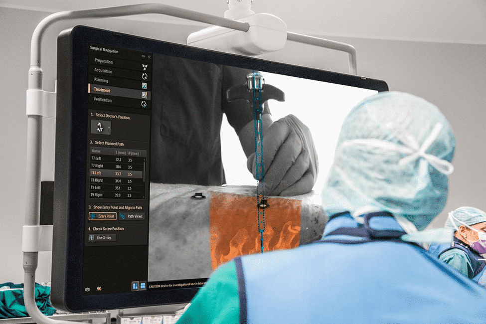 Intraoperative Neuromonitoring vs EEG: What’s the Difference