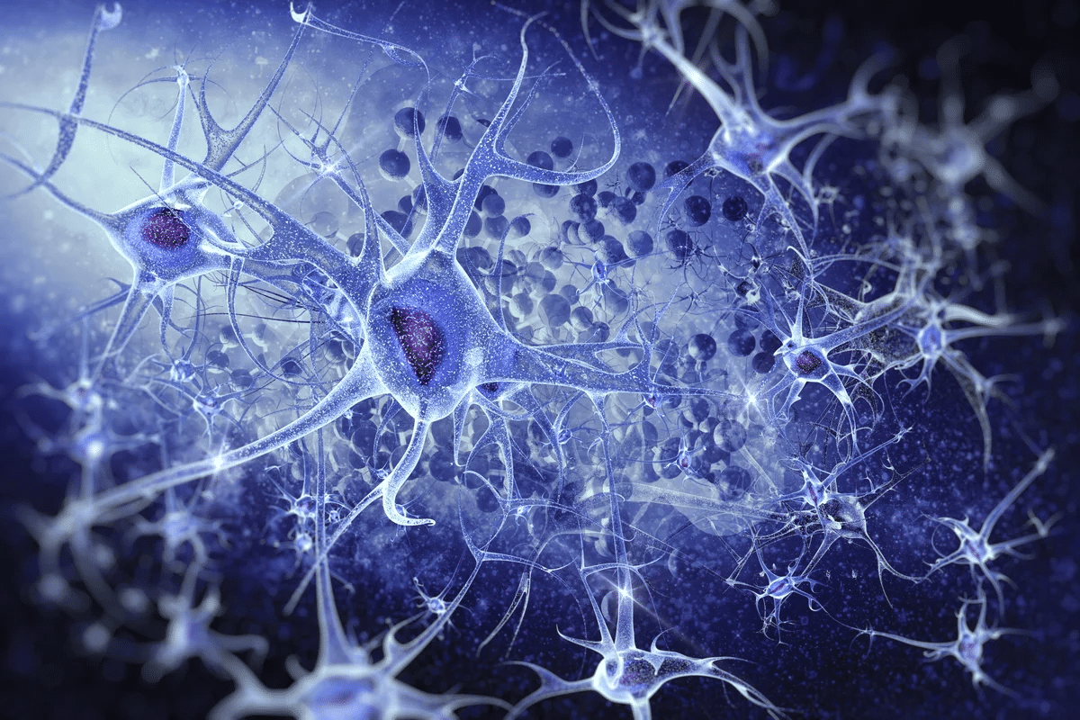 What Kills Neurons? Best Prevention Tips