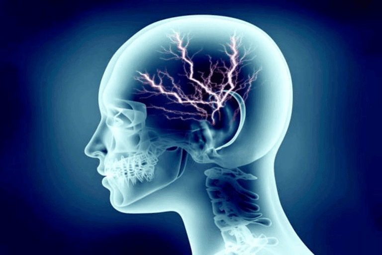 Does the Brain Have Nerves? Best Facts