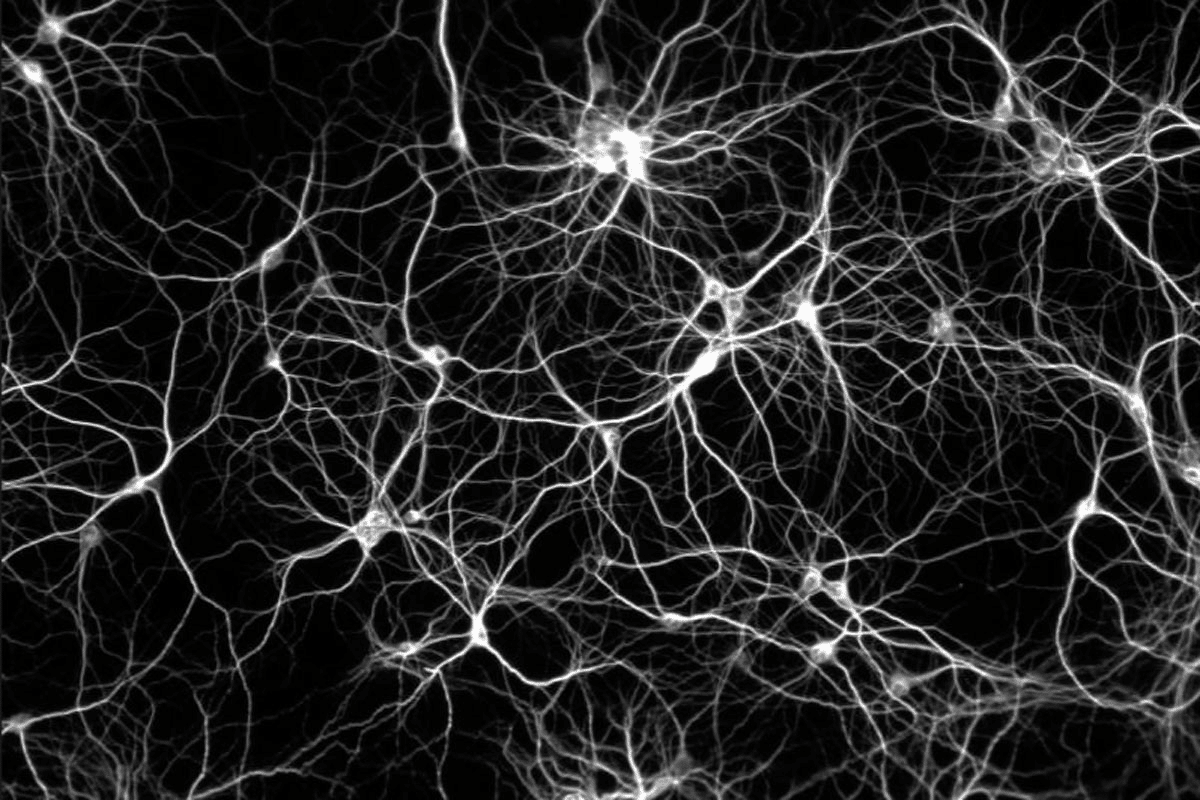 Brain Cells Are Neurons: Best Facts