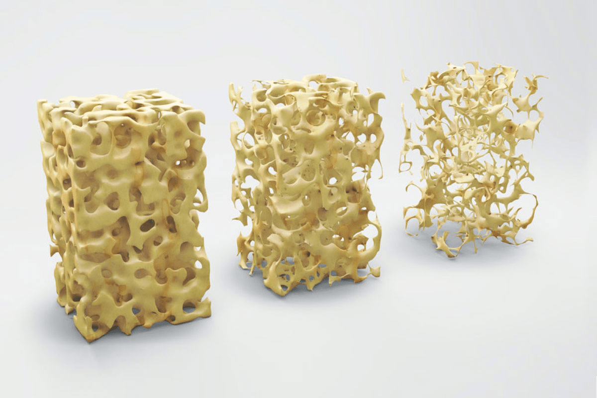 Calcium D3 Dosage: Best Safety Guide 2 Calcium D3 Dosage: Best Safety Guide