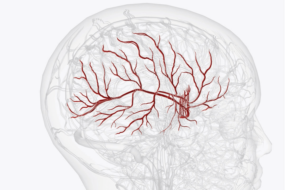 Amyloid Angiopathy: Best Medical Facts