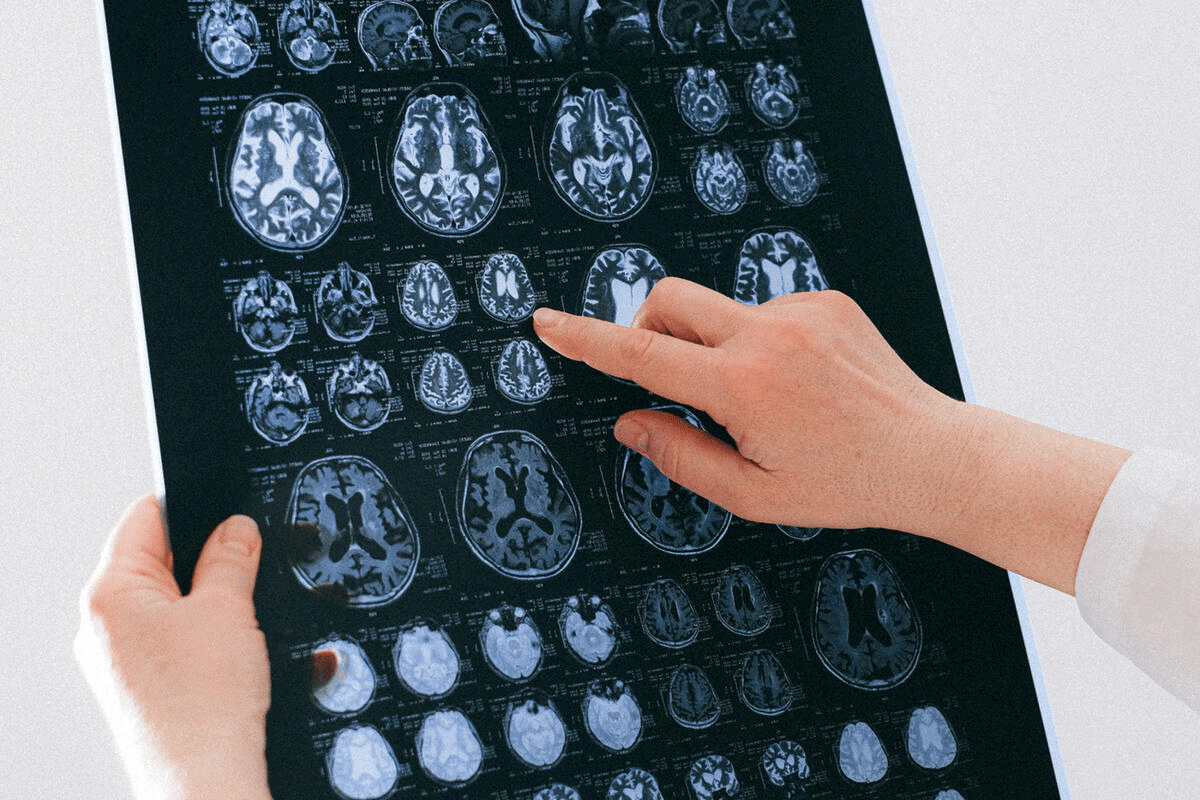 How Can You Tell If You Have Brain Damage? 3 How Can You Tell If You Have Brain Damage?