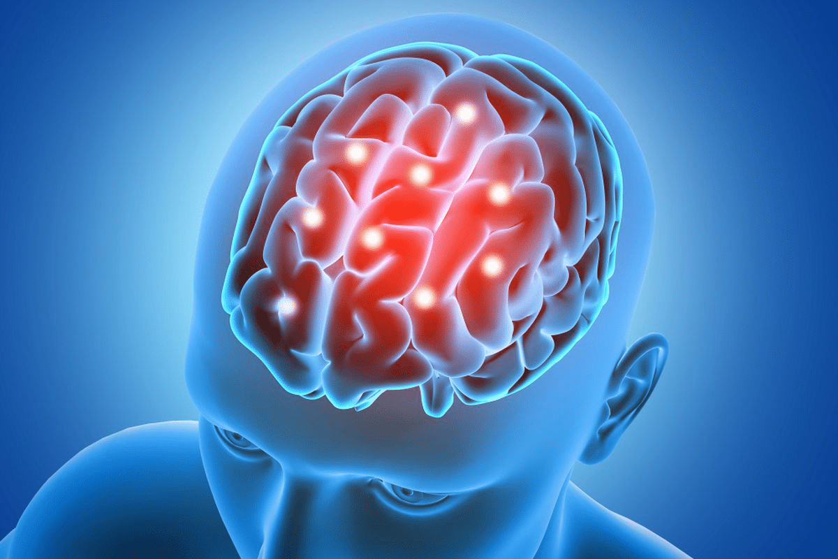 Brain Issues Symptoms: Best Vital List