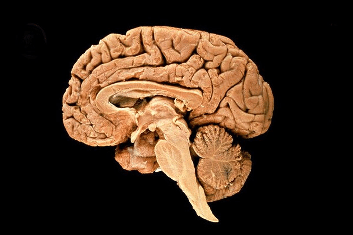 Brain Basics: Best Vital Anatomy Guide
