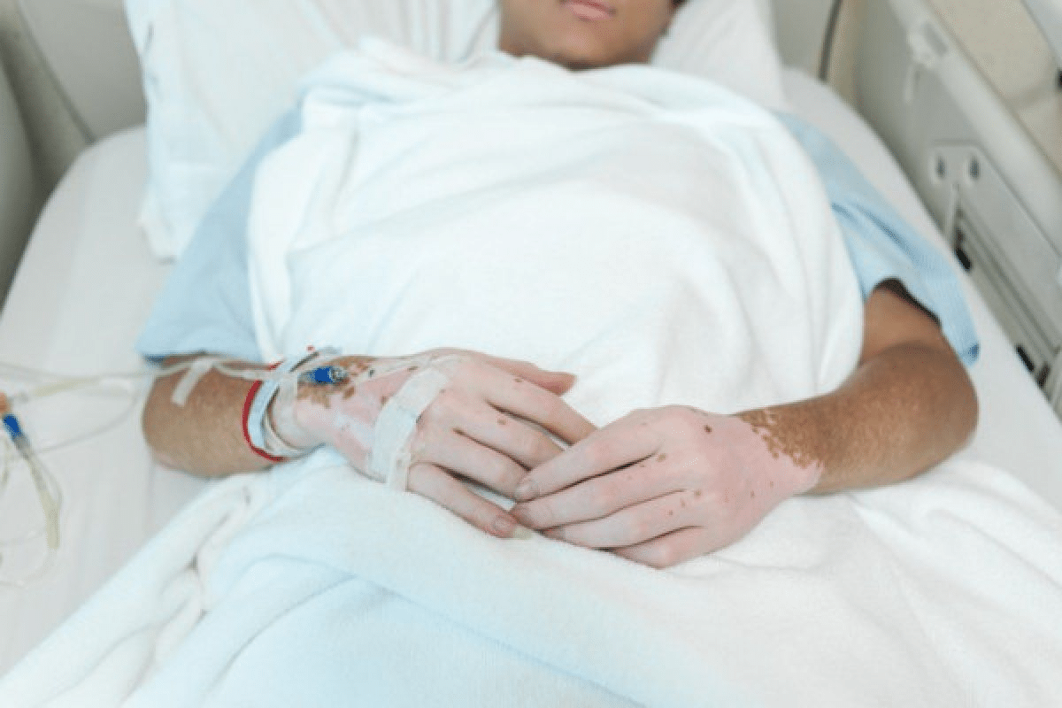 Valuable Lupus Life Expectancy Women: What To Know