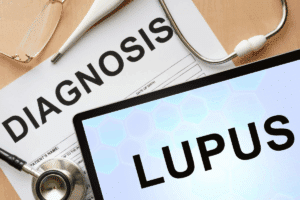 Key Can Lupus Disease Death Occur: Understanding Risks