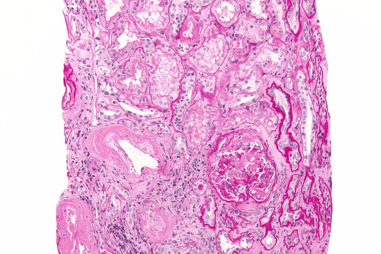 Other Words for Dementia: A Complete List