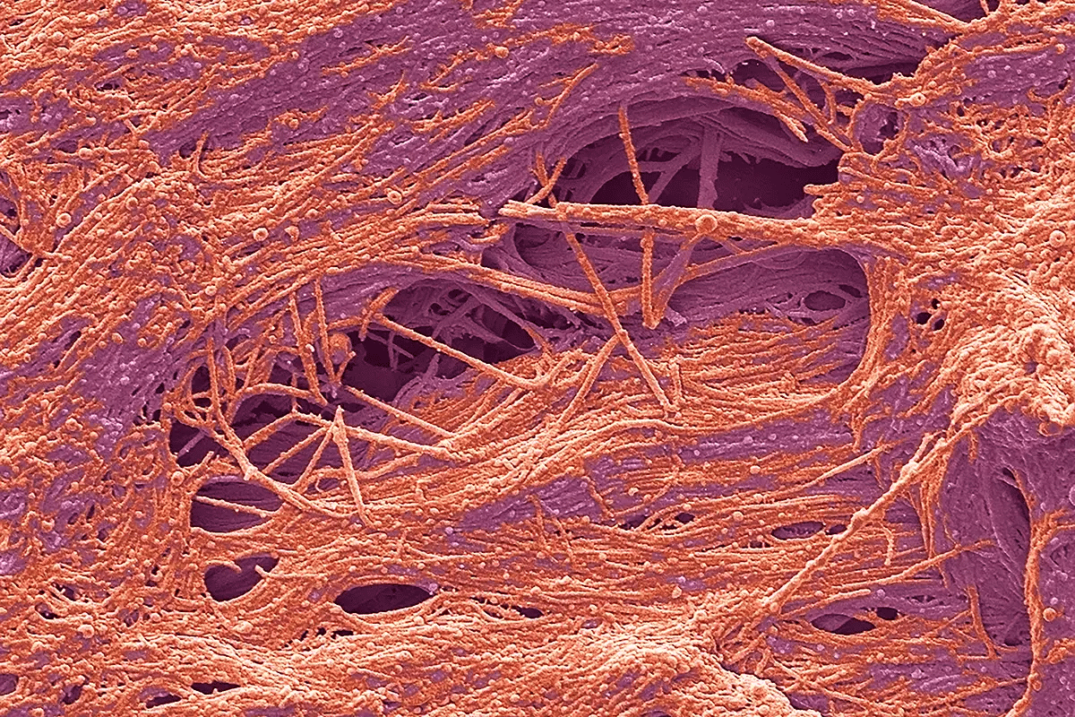 ATTR Amyloidosis Symptoms: A Complete Guide