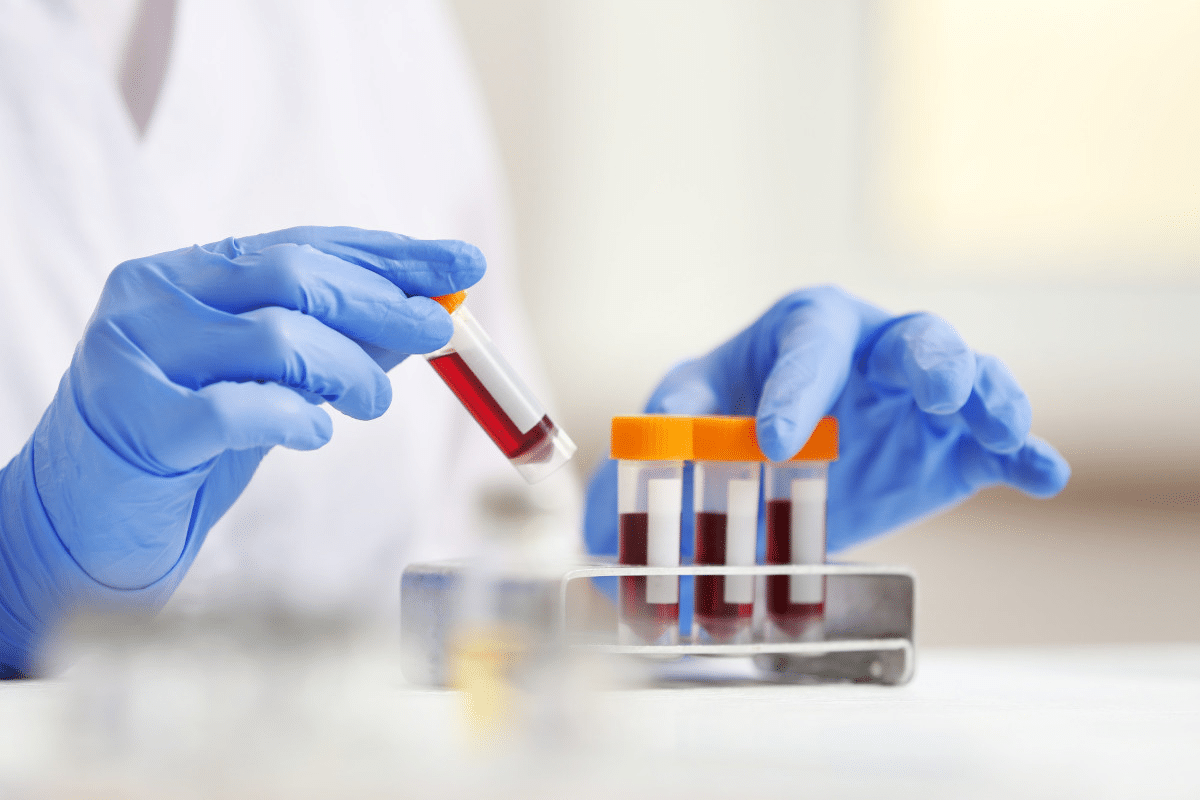 Blood Test for Bone Loss: 5 Essential Labs