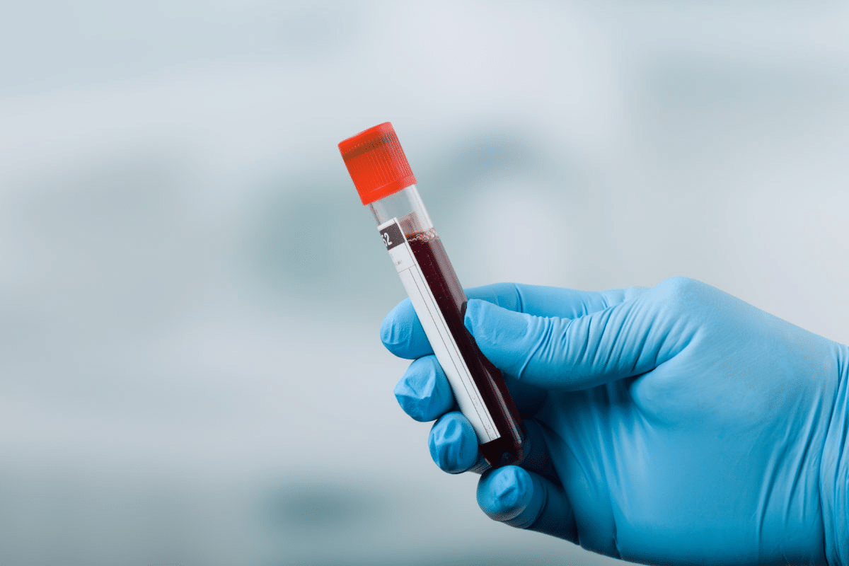 Blood Test for Dementia: Is There One Yet?