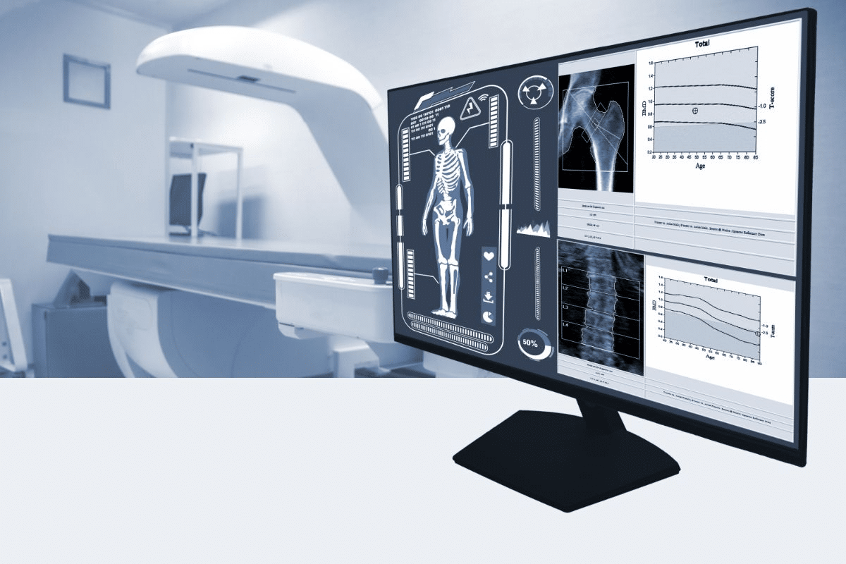 Would a Bone Density Scan Show Cancer?