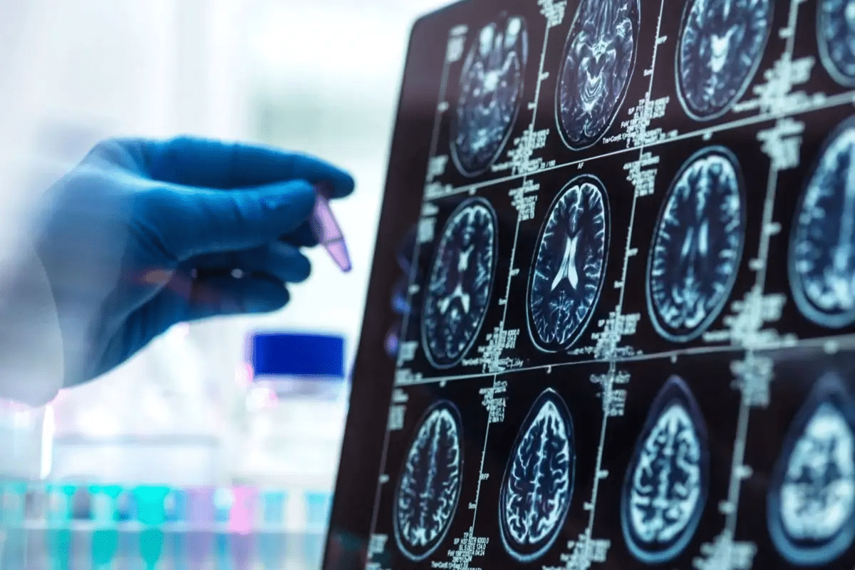 Alzheimer Journal: Top Research & Impact Factor 2 Alzheimer Journal: Top Research & Impact Factor