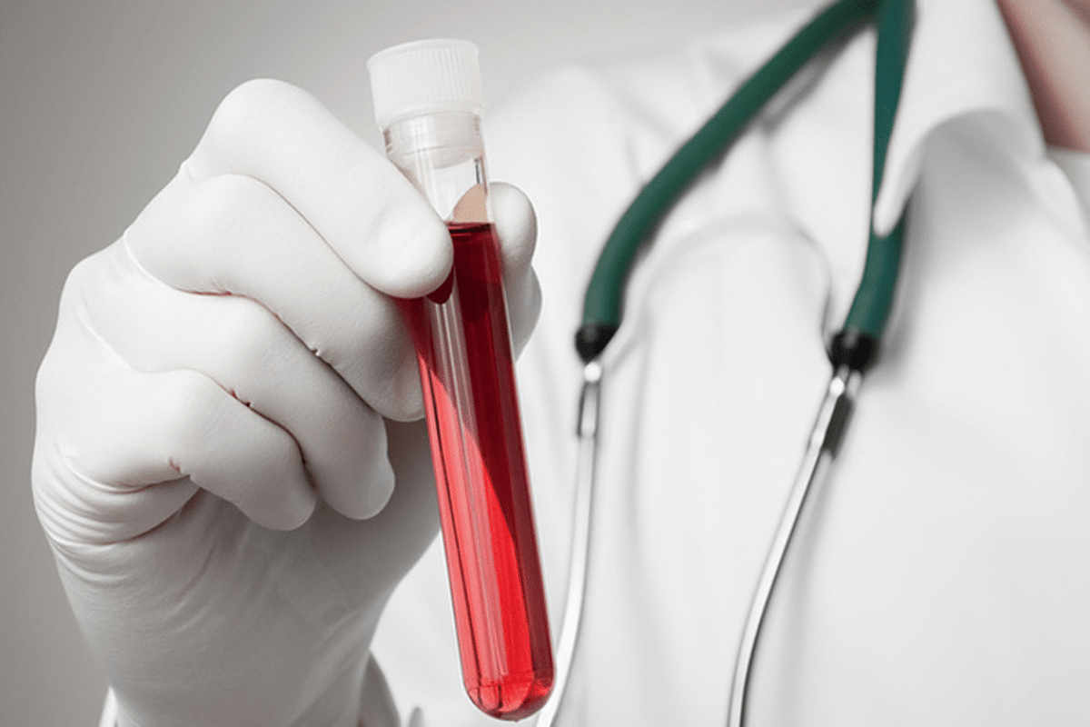 Guide What Is Anti CCP Test & What Does A Positive Result Mean?