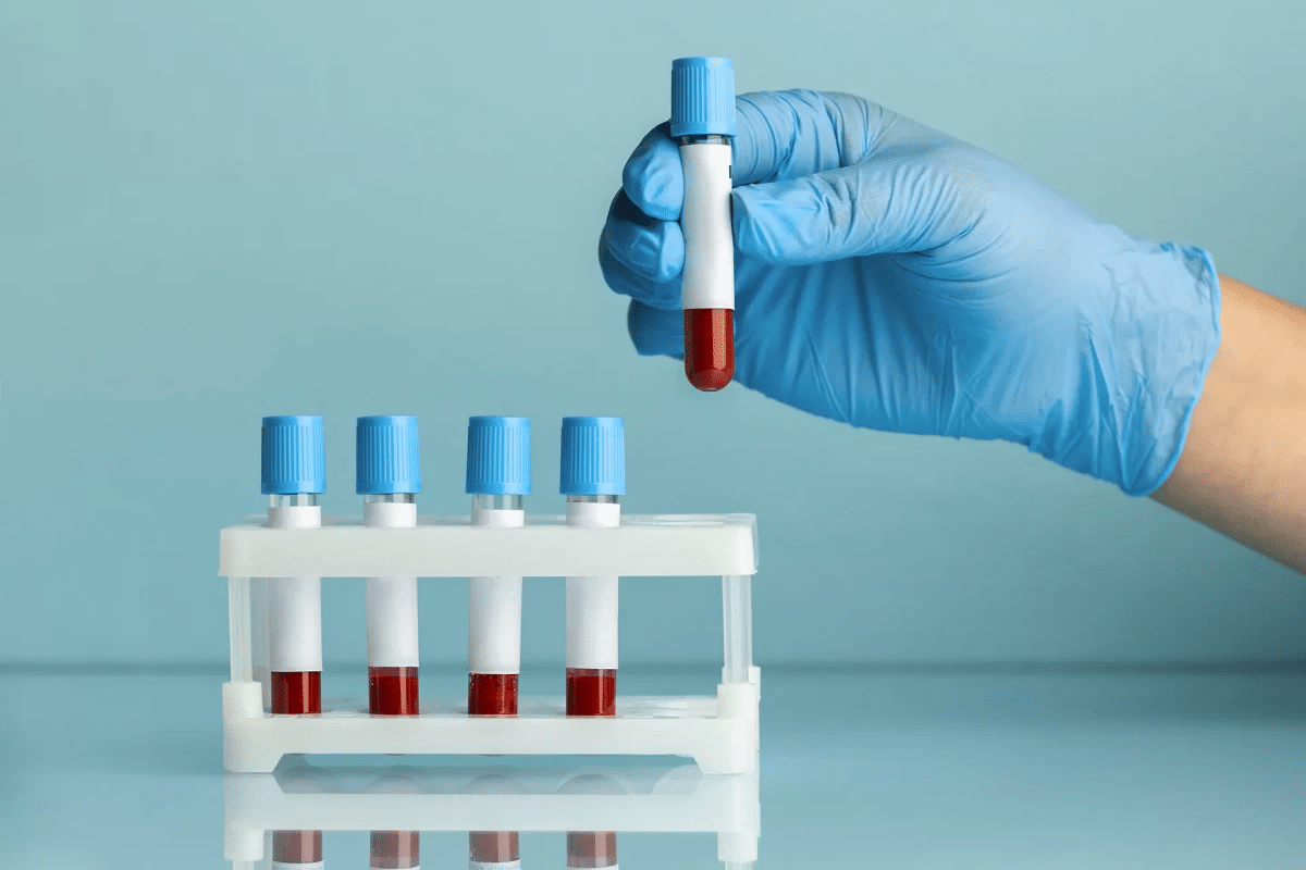 Profound What Is The CCP Test And What Do Results Mean?