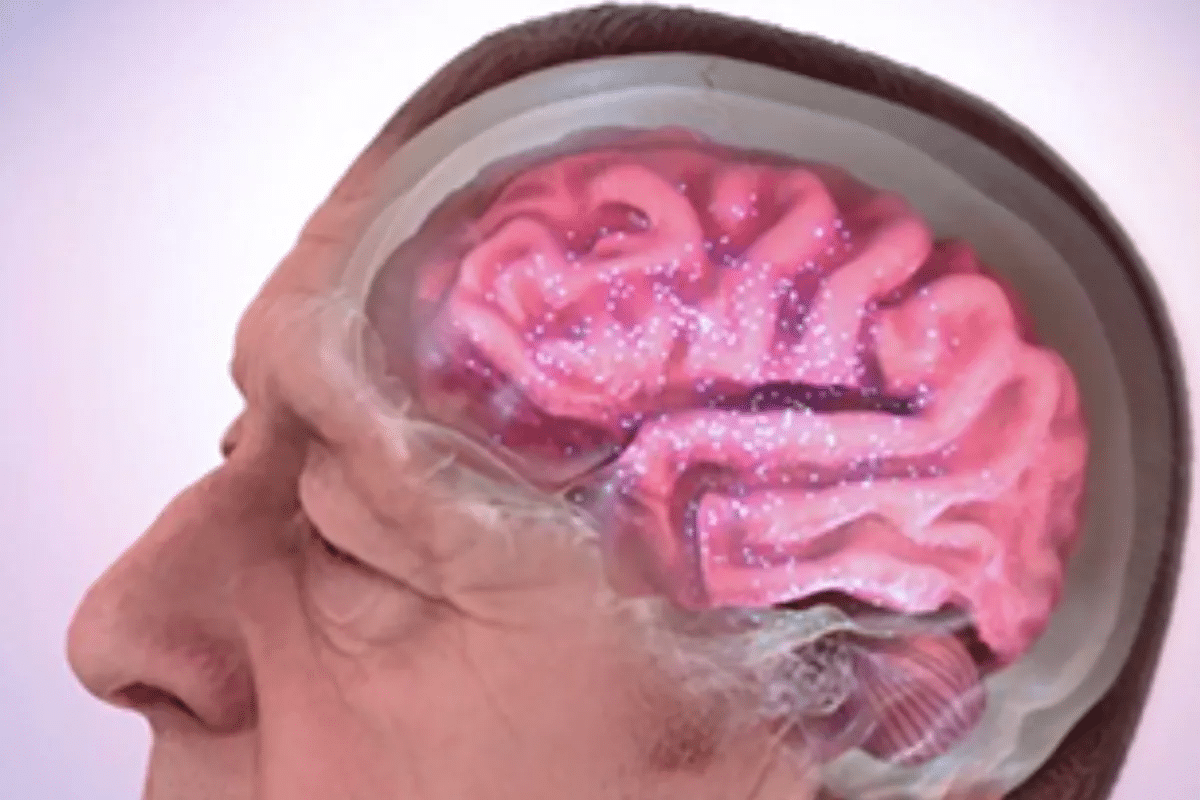 Alzheimers Disease Cure: Latest Research Hope