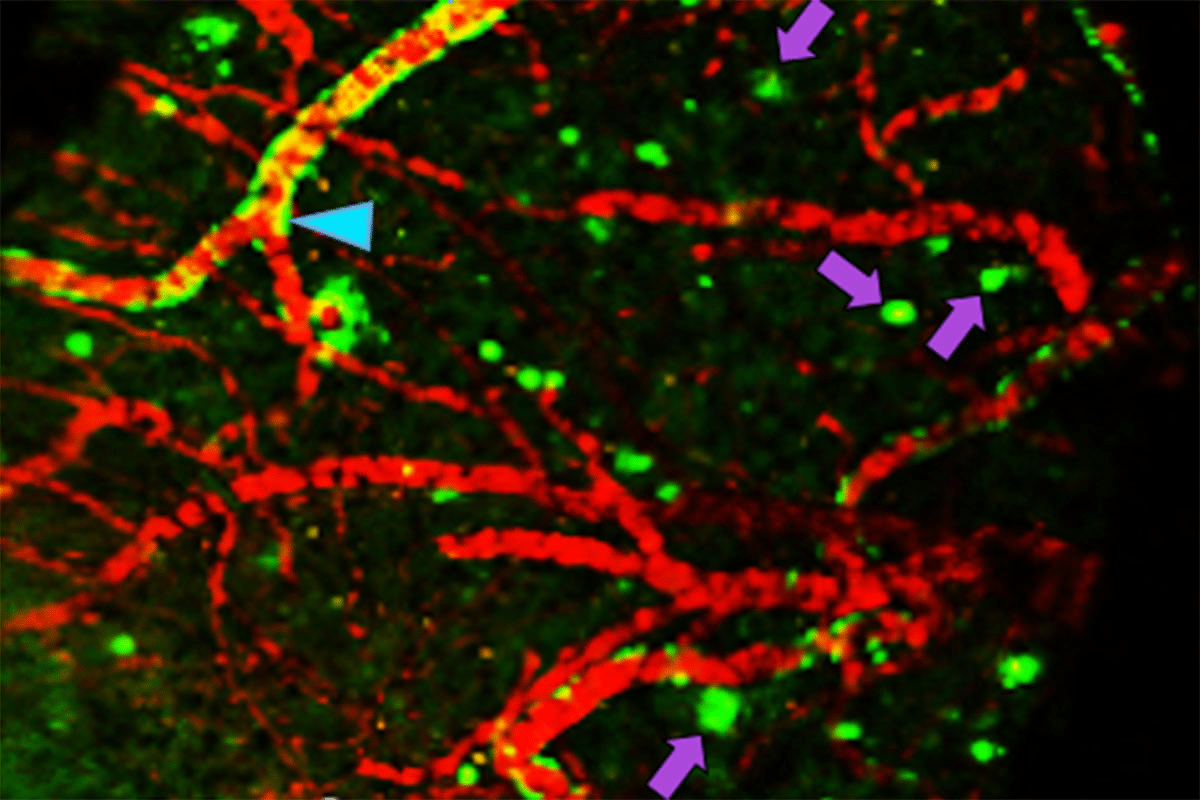 How to Diagnose Alzheimer Disease: Best Guide