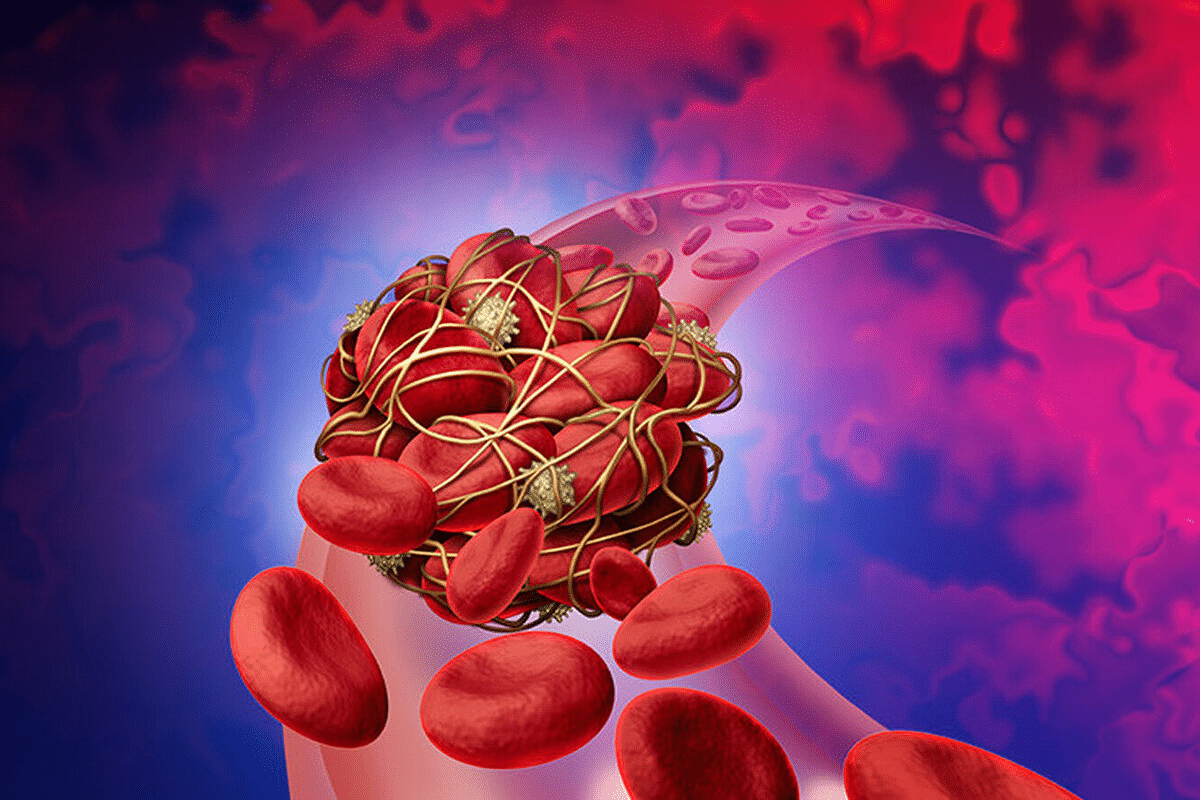 Crucial What Causes Foot Blood Vessels Bursting?