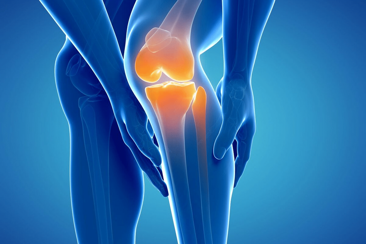 Simple Complete Guide To Treat Calcium Buildup In Knee 2 Simple Complete Guide To Treat Calcium Buildup In Knee