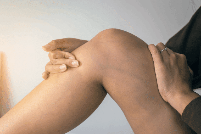 Essential How To Treat A Busted Vein: Recovery Guide