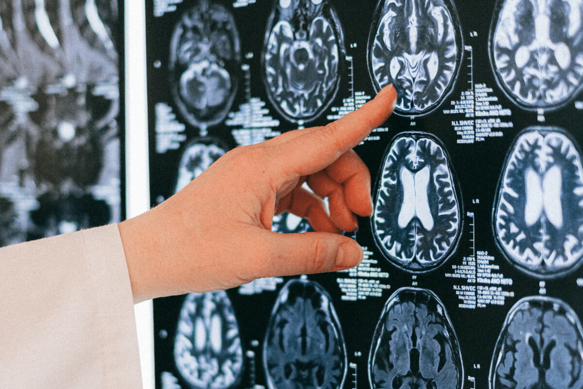 Diagnostic Alzheimer Test: The New Best Options