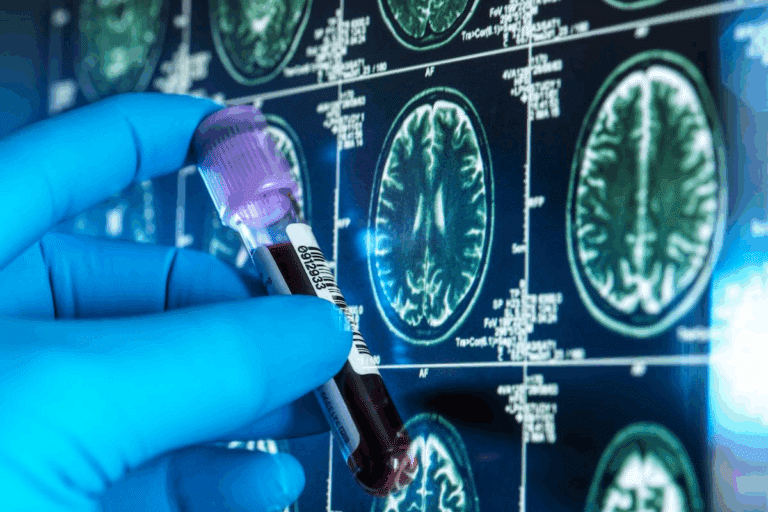 AD Diagnosis: The 5 Key Criteria You Must Know