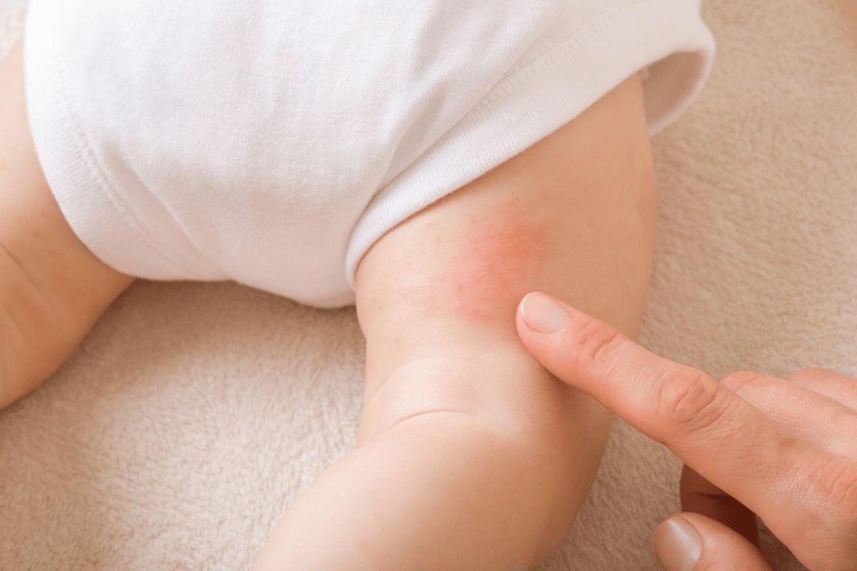 Essential 5 Types Of Small Vessel Vasculitis & Diagnosis