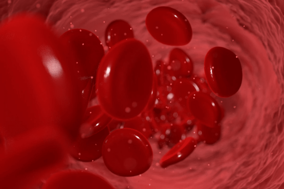 Essential Leukocytoclastic Vasculitis Cure & Treatment