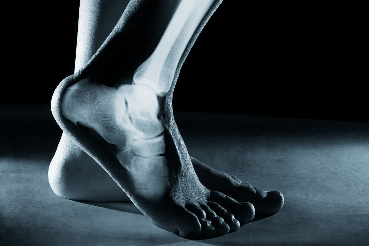 Amazing Arthropathy Definition: Complete Medical Meaning 3 word image 246790 3 LIV Hospital