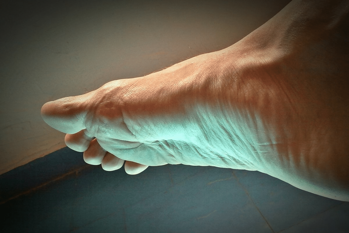 Complete Can Colchicine Cause Inflammation: How It Works