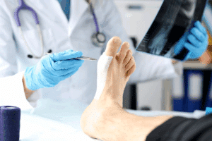 Complete Can Colchicine Cause Inflammation: How It Works