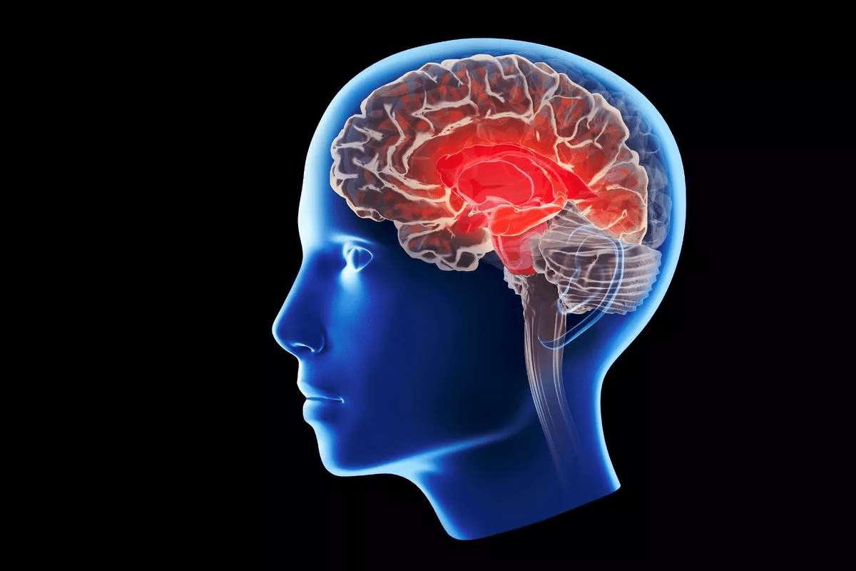 Foods That Cause Dementia: 5 Dangerous Ingredients to Avoid