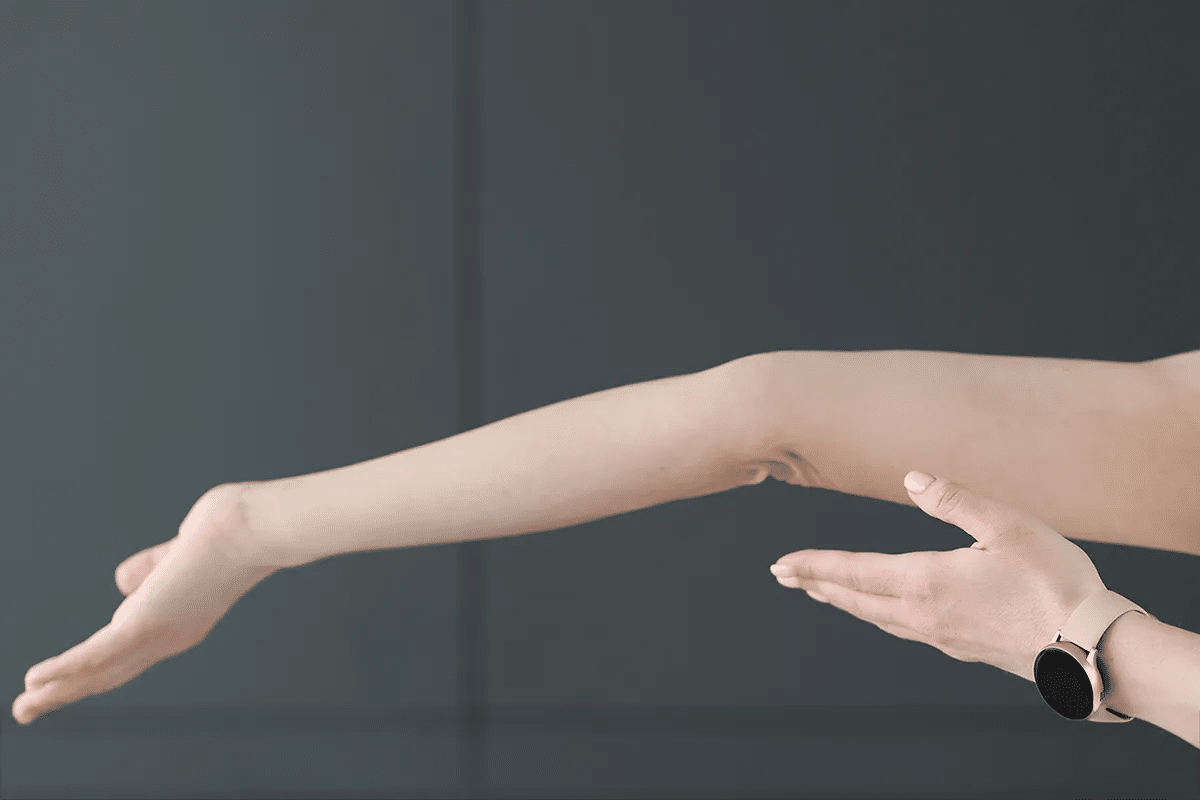 Guide 13 EDS Types: Symptoms, Causes & Classification