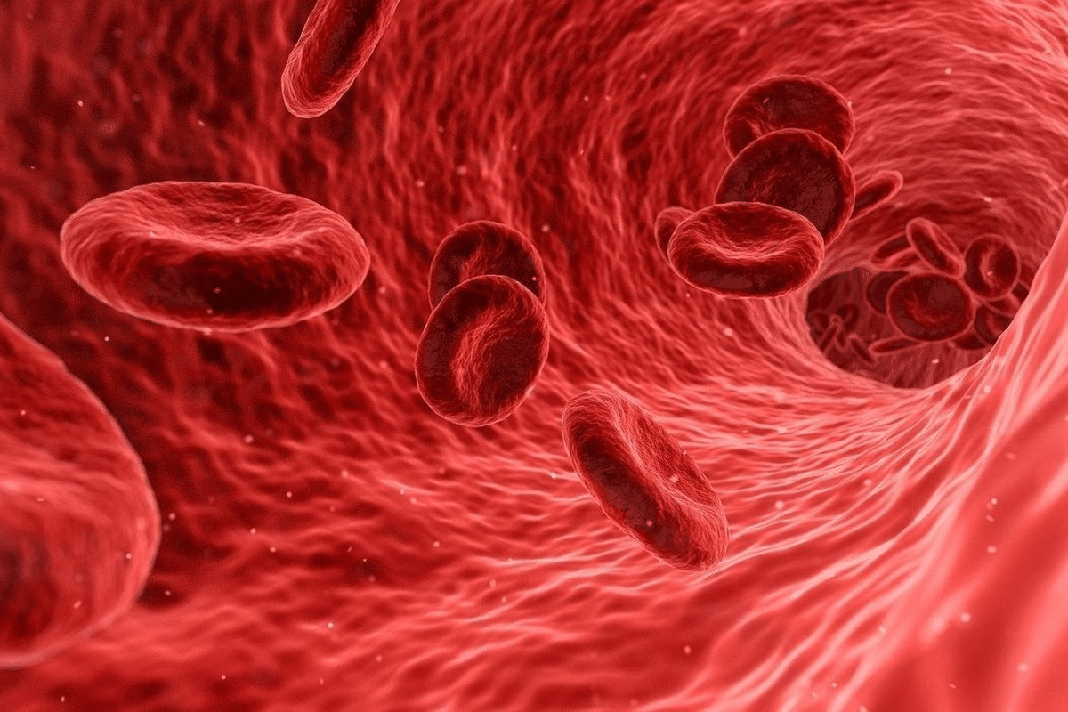 Profound 7 Connective Tissue Disease Hereditary Patterns