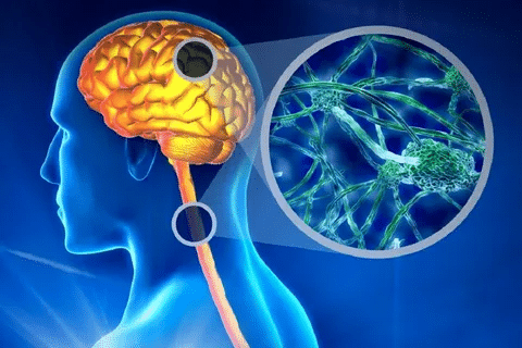 Complete Is MS Hereditary: Genetic Factors & Risk