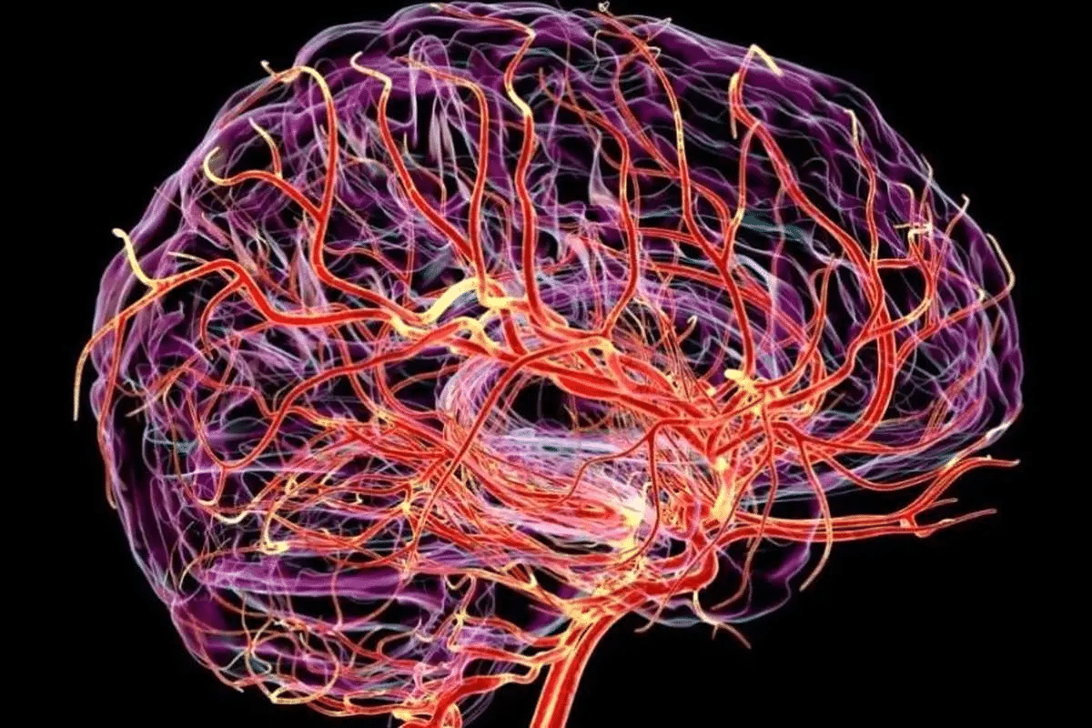 Valuable 7 Key Causes Of Nervous System Vasculitis