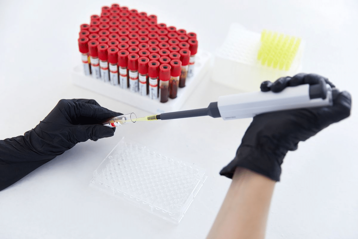 Ultimate What Is An ANA IFA Test & Results Mean?