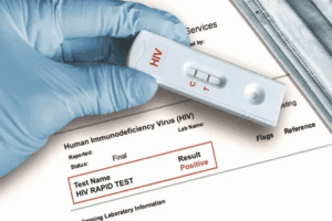 Guide What Does A Positive ANA Test Mean For Health?